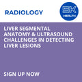 Liver Segmental Anatomy & Ultrasound Challenges in Detecting Liver Lesions